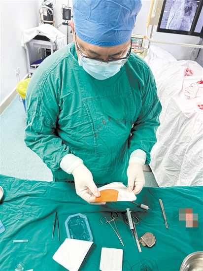 醫(yī)生在準備TYRX可吸收抗菌封套。